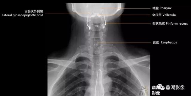 人体气管和食管位置图,人的食管和气管的位置图片(2)