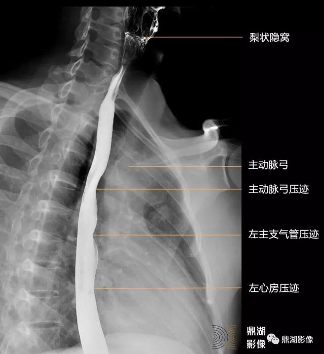 人体气管和食管位置图,人的食管和气管的位置图片(3)
