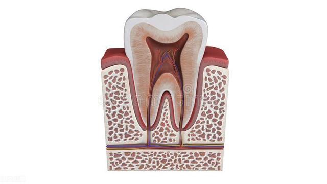 牙髓炎最怕的克星,牙髓炎一招立马止疼(2)