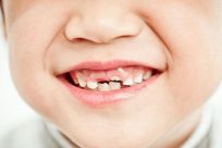 人类为什么有乳牙和恒牙?人一生换两次牙(符合骨骼生长)