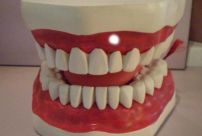 牙齿怎么更快变白 几种小方法让牙齿更白（相当简单）