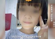 贵州9岁被砍女童母亲发声 为保护自己才受伤