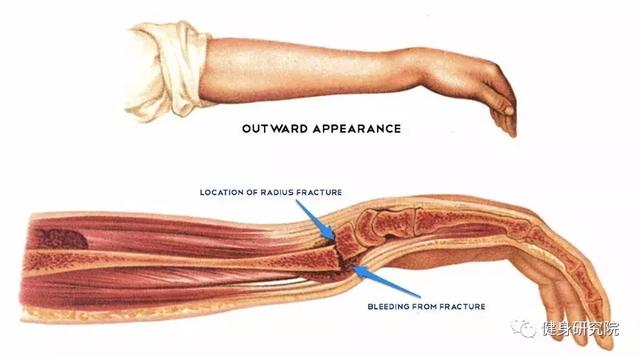 手腕劳损快速恢复方法,手腕不肿一用力或旋转就疼(4)