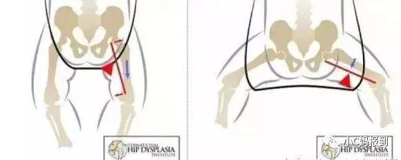 刚出生婴儿背带使用步骤图解,婴儿背带正确姿势图解(2)