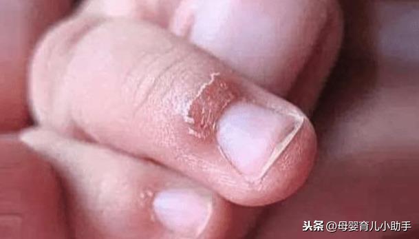 刚出生的婴儿多久能剪手指甲,刚出生几天的宝宝手指甲能剪吗(5)