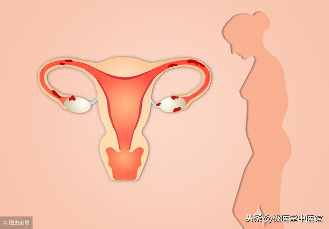 吃什么子宫肌瘤会消除,子宫肌瘤的克星(2)