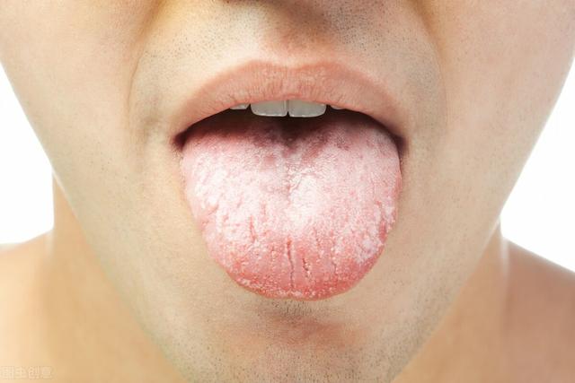 舌根发硬说话不自然,舌根发硬说话不自然怎么回事(3)