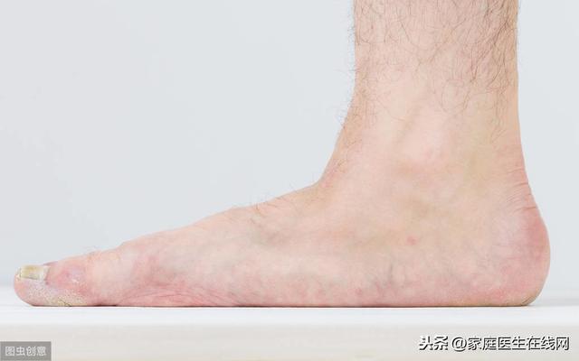 大脚趾甲增厚,灰指甲治愈最简单方法(1)