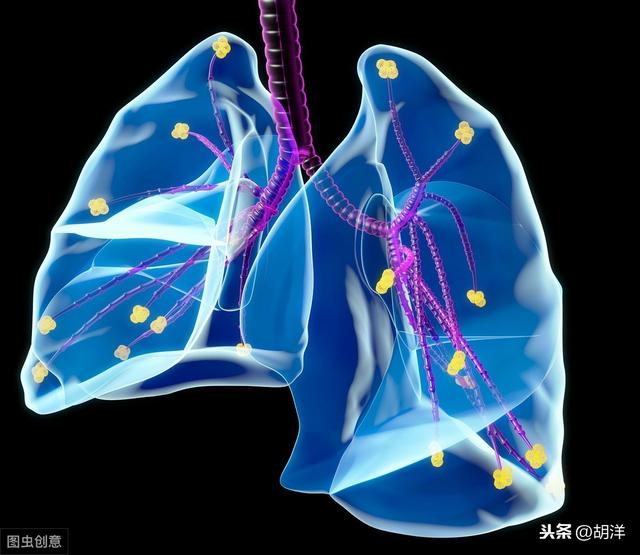 肺大泡怎么保养呢,肺大泡锻炼身体竟然消失了(2)
