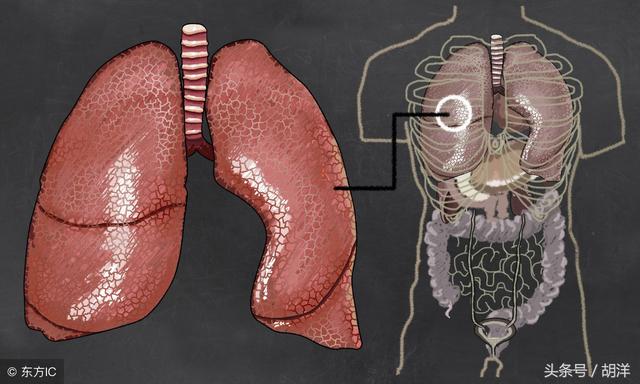 肺大泡能自己恢复吗,肺大泡的人能活多久(2)