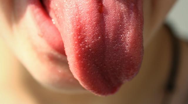 舌头最怕出现这10种变化,肝火旺盛的舌头图片(4)