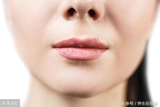 嘴唇干裂用红霉素软膏,唇干是大病前兆(2)