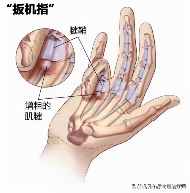 50岁左右手指肿胀的七种原因,手指头关节肿胀疼痛解决最好办法(2)