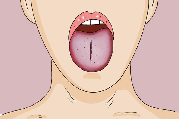 每天刷舌苔到底好不好,每天刷舌苔的坏处(2)