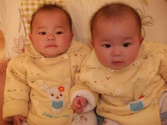 是异卵双胞胎好还是双卵双胞胎好,同卵双胞胎好还是异卵好(3)