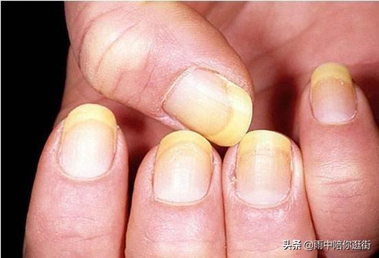 偶尔抹一次指甲油有害吗,(3)