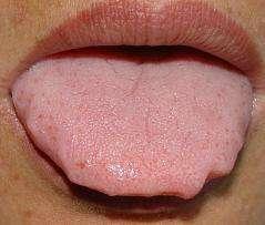 怎么练习舌头有力量,怎样练习自己舌头的力度(4)