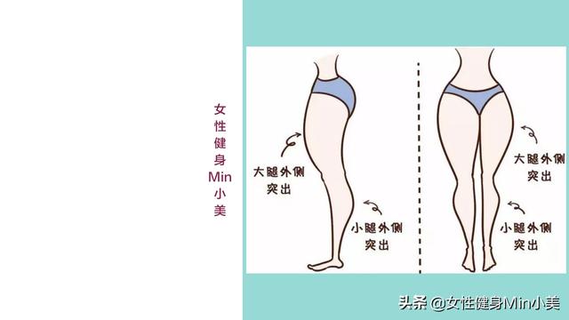 大腿外侧粗壮是什么原因,大腿粗壮的原因有哪些(2)