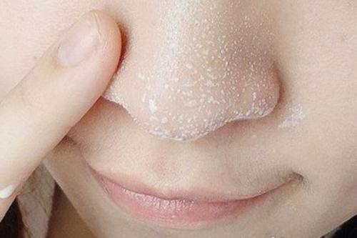 去脸上的黑点怎么洗脸最有效,(2)