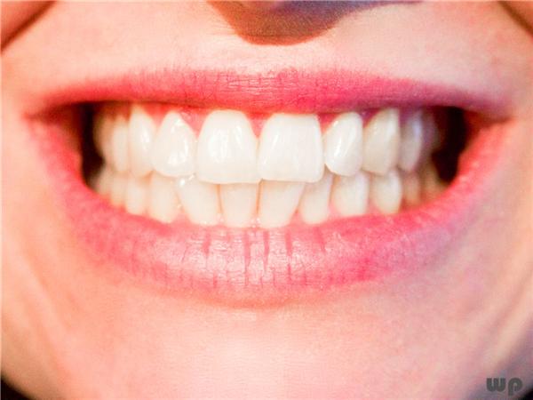 为什么牙缝一抠是臭的,牙缝臭用手抠特别臭漱口水有用吗(1)