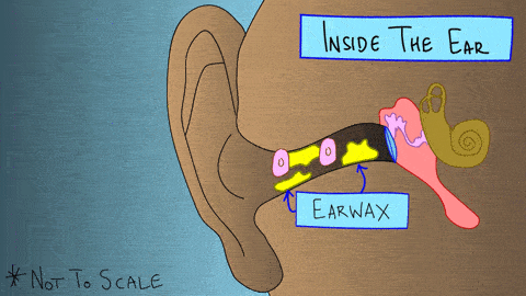 耳屎怎么形成的,耳屎堵塞最快的解决方法(3)