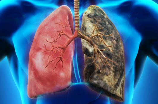 胆管癌和肝癌能活多久,胆管癌和肝癌哪一个更严重(2)
