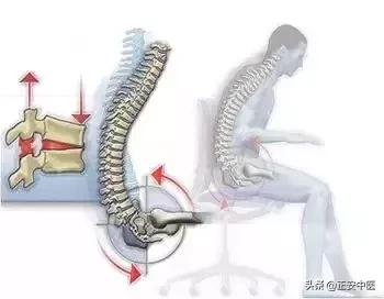 一张一看就懂的腰痛图,腰疼的七种位置图(3)