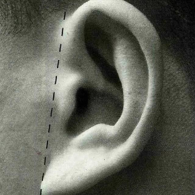 耳垂皱纹怎么消除最快,怎么消除耳朵前皱纹(1)