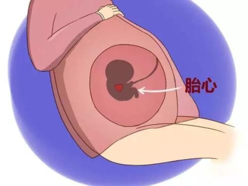早孕10天胚芽发育情况,*胚芽10mm是多久(2)