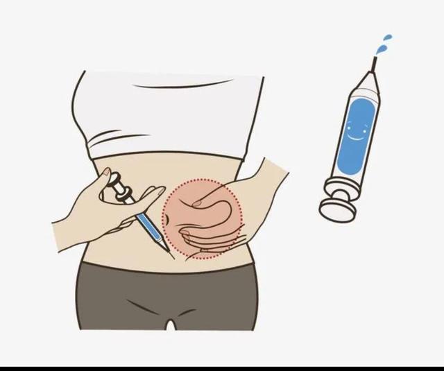 孕妇打肝素部位图解,孕妇打肝素的位置图(1)