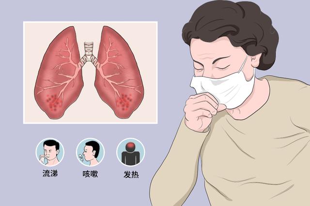 气管炎咳嗽止咳最快治疗方法,支气管炎最怕三种食物(1)