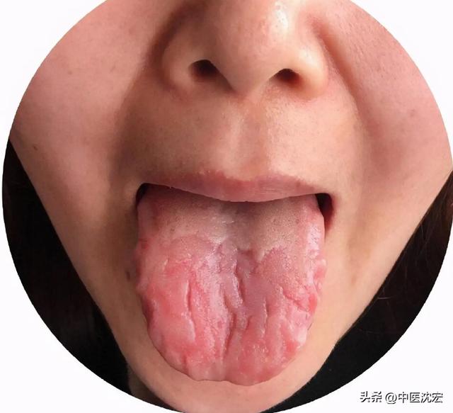 舌中间麻的原因和治疗方法,舌根发麻的原因及解决方法(2)