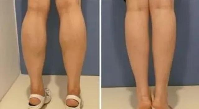 瘦腿部刮痧正确方法,怎样刮痧瘦腿最快图解(1)