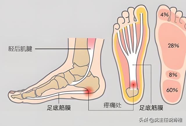 脚后跟痛怎么治疗最快方法,脚后跟疼最好最快的治疗方法(2)