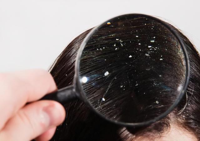 盐水洗头发的利弊,用清水洗头半年的效果(4)
