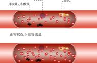 地暖太热关了一半会不会堵塞（地暖太热关小后容易堵吗）