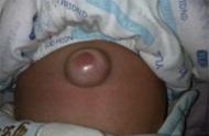 两个月宝宝肚脐眼突出怎么回事啊（二个月的宝宝肚脐凸出来怎么回事）