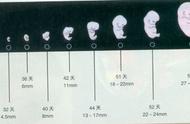 33周胎儿双顶径正常是多少（胎儿33周双顶径多少为正常）