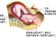 子宫开口器视频（子宫开口器疼吗）