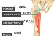 耻骨痛示意图（耻骨痛是怎么痛法）