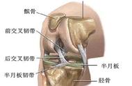 十字韧带撕裂什么感受（十字韧带撕裂感觉出来吗）