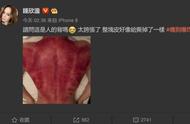 女性为什么不建议刮痧（刮痧对女人的身体有什么好事）