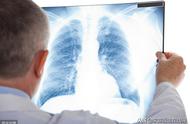 判断肺癌的最好方法（肺癌晚期快不行的征兆）