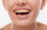 牙齿容易变黄是什么引起的呢（牙齿变黄的主要原因是什么）