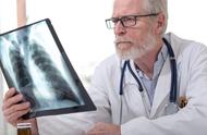 早期肺癌可能永远不复发（轻度肺癌早期的8个信号）