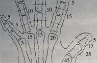 手足功能缺损伤残鉴定标准（小指缺损能鉴定几级伤残）