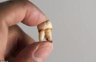 32颗牙齿女人的命运解析（32牙与28牙哪个好）