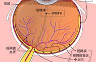 为什么中国人的瞳孔是黑色的（为什么有人的瞳孔是全黑的）