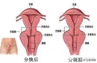 缩肛练习动图（缩肛运动的正确方式图解男士）