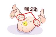 婴儿肌张力高表现图片（婴儿肌张力高能治好吗）